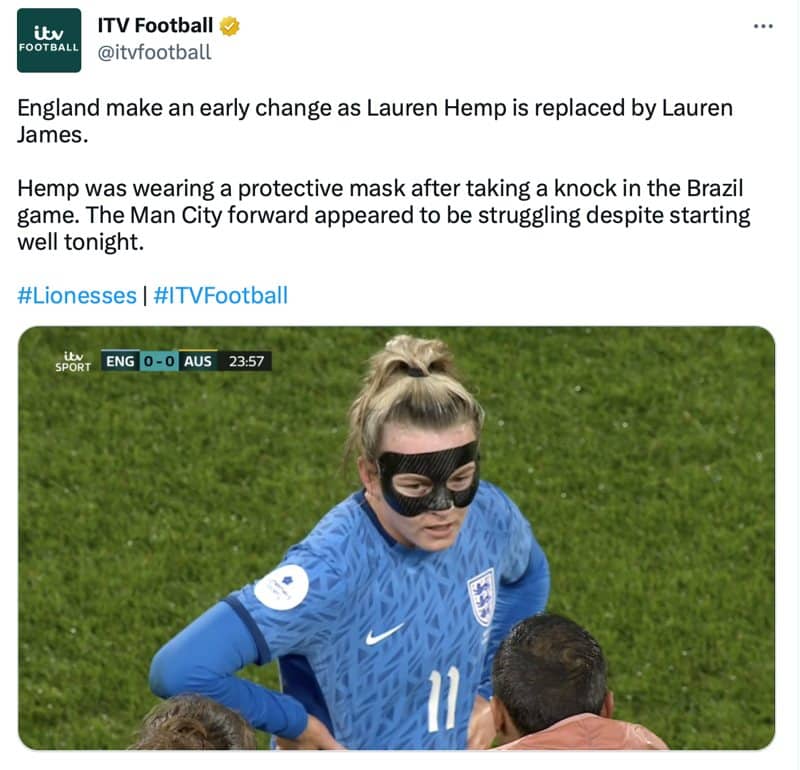 England's Lauren Hemp with face-protecting mask, but nothing to save her hair